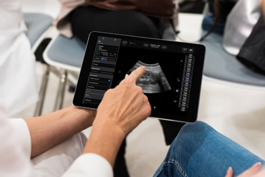 Samsung investit jusqu’à 100 millions de dollars dans la startup Exo pour révolutionner l’imagerie médicale portable